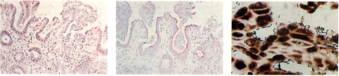 吞下幽门螺旋杆菌后第10天的胃黏膜和腺体，图三有显色的细菌